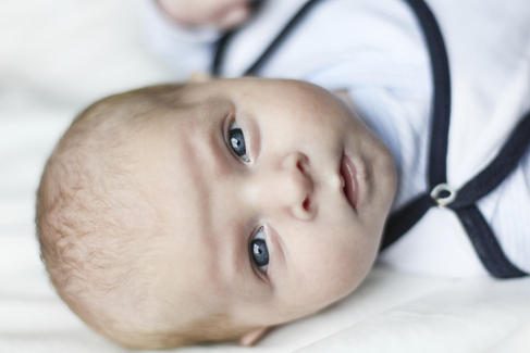 What is hypospadias?