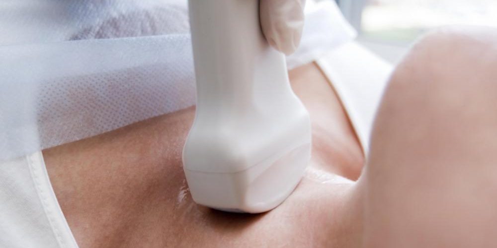 The thyroglossal cyst what is the thyroglossal cyst ?