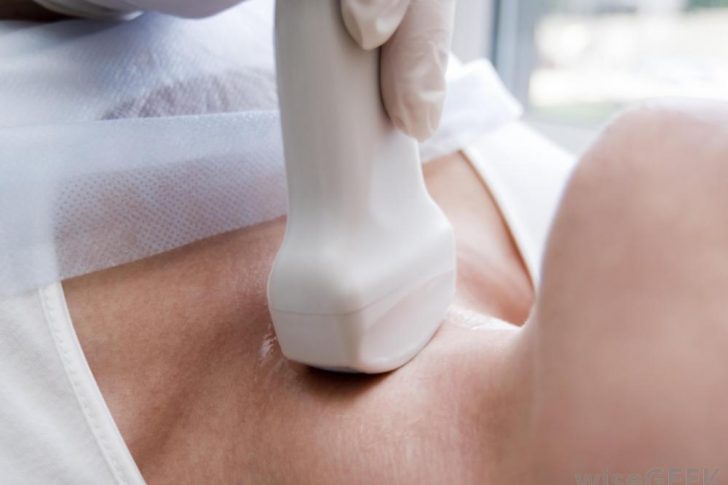 what is the thyroglossal cyst ?